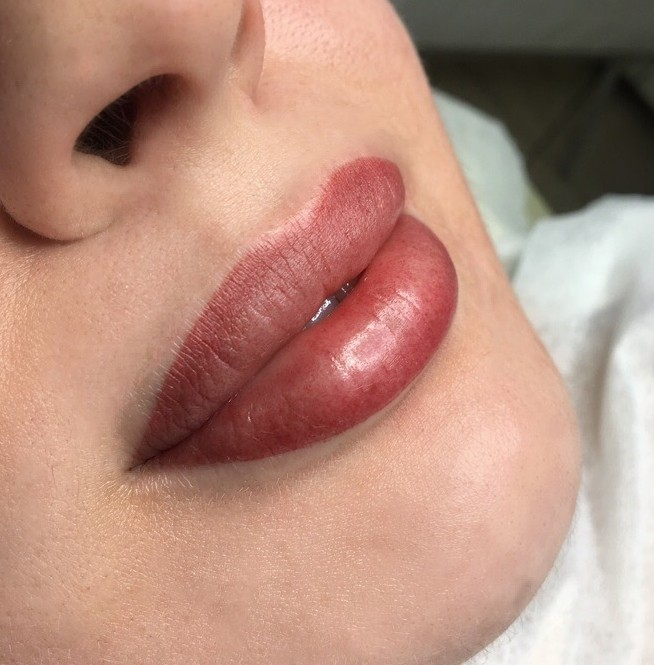 Trucco Permanente delle labbra (subbito dopo trattamento)