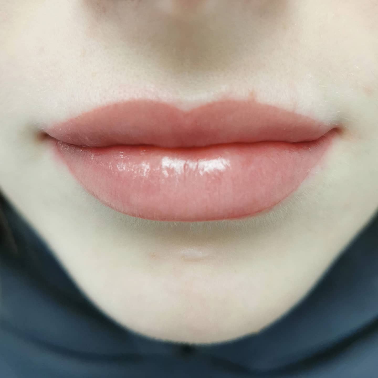 Trucco Permanente delle labbra (subbito dopo trattamento)
